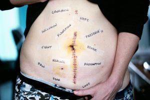 Implantable Sensors: The Future of Personalized Healthcare